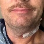 Ator famoso revela diagnóstico de câncer ligado ao HPV e faz alerta: ‘Vacinem seus filhos’