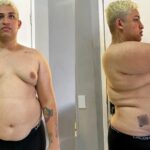 Influenciador perde quase 50 kg e aparece irreconhecível; veja