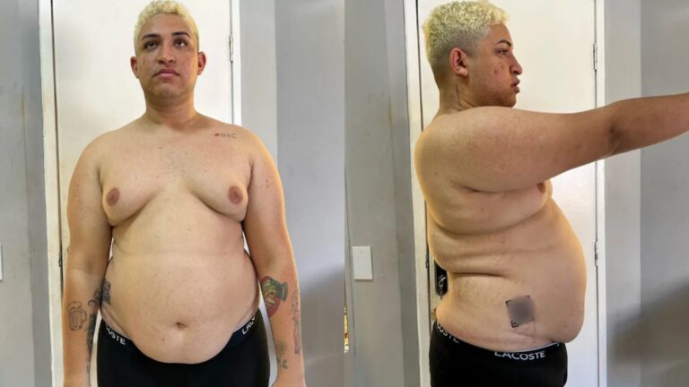 Influenciador perde quase 50 kg e aparece irreconhecível; veja