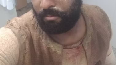 Ator encontrado morto no Rio foi torturado antes de ser assassinado