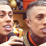 MC Daniel faz procedimentos no rosto e espanta os seguidores: ‘Terá problema facial’; veja