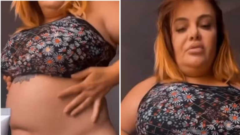 Valentina Francavilla exibe antes e depois após perder 45 kg e surpreende seguidores
