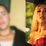 Após investir R$ 500 mil, Mulher Abacaxi expõe transformação radical com antes e depois