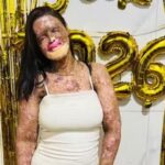 Urgente: Influenciadora morre após luta contra doença rara