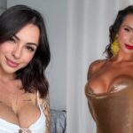 Influenciadora se arrepende de aplicar botox aos 26 anos e tenta reverter procedimento: ‘Me senti mais velha’
