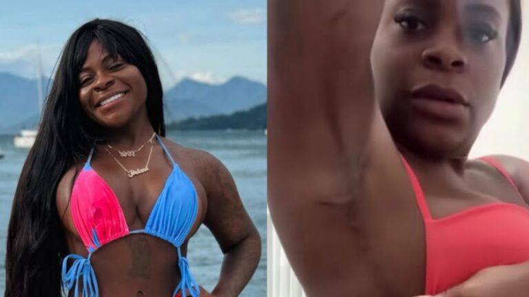 Detalhe no corpo de Jojo Todynho após cirurgia desperta curiosidade nas redes