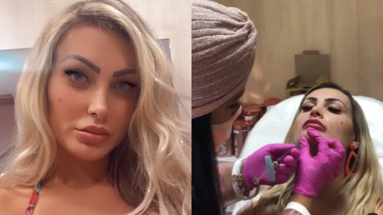 Andressa Urach faz mais um procedimento estético e fãs relembram quase morte: “Não aprendeu a lição”