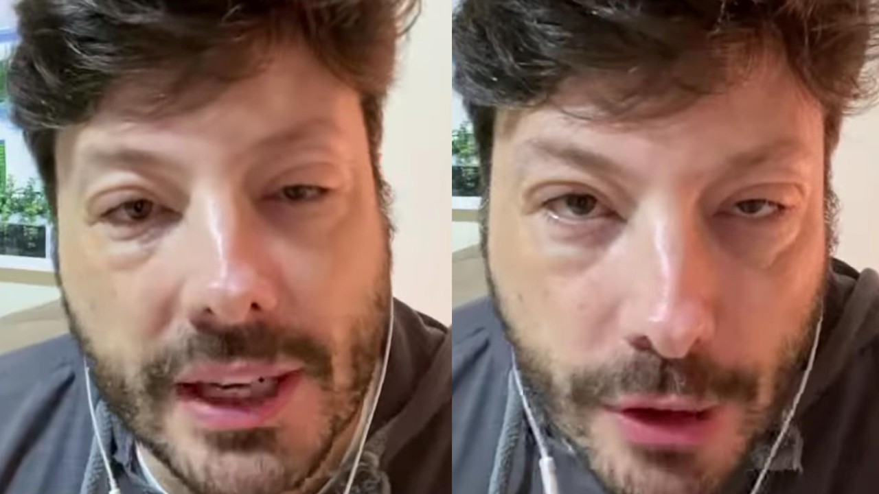 Danilo Gentili causa espanto e preocupa fãs ao surgir com o rosto deformado: “Passei maus bocados”