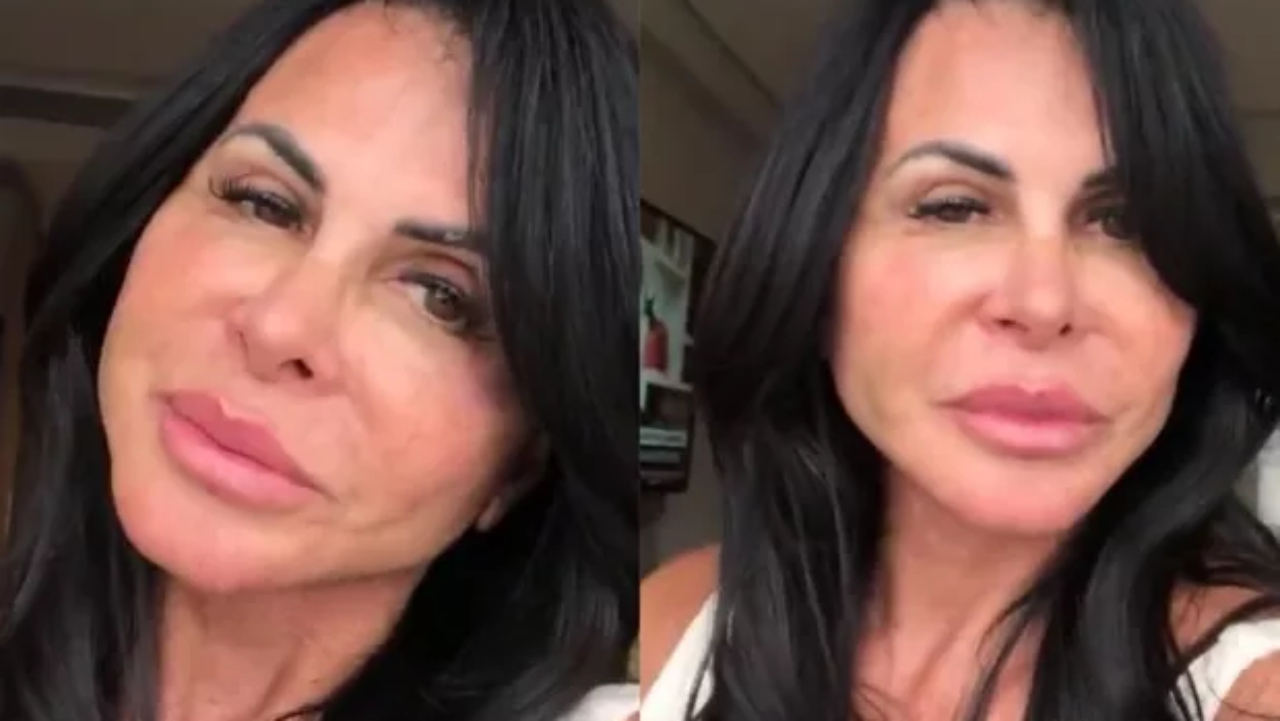 Aos 61 anos, Gretchen passa por novo procedimento cirúrgico: ”Estou me amando”