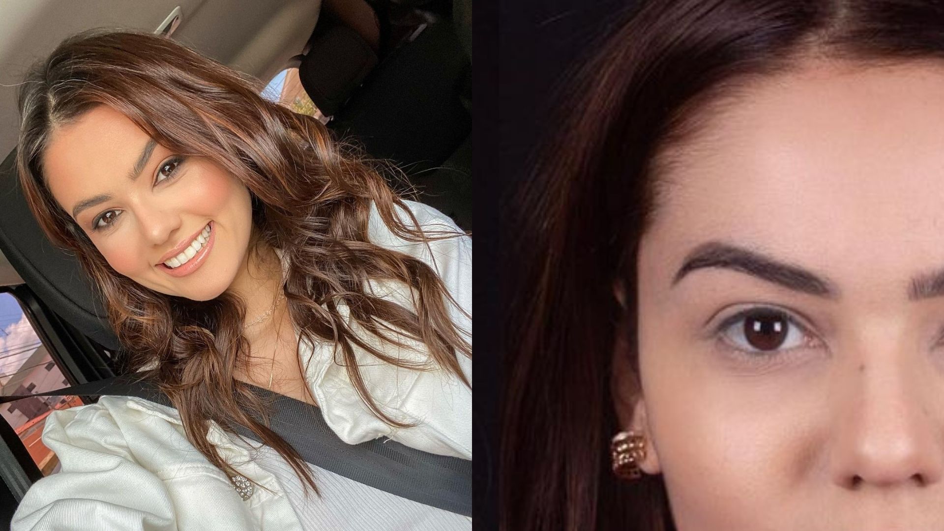 Outra pessoa? Ex-BBB Eslovênia passa por harmonização facial e resultado choca