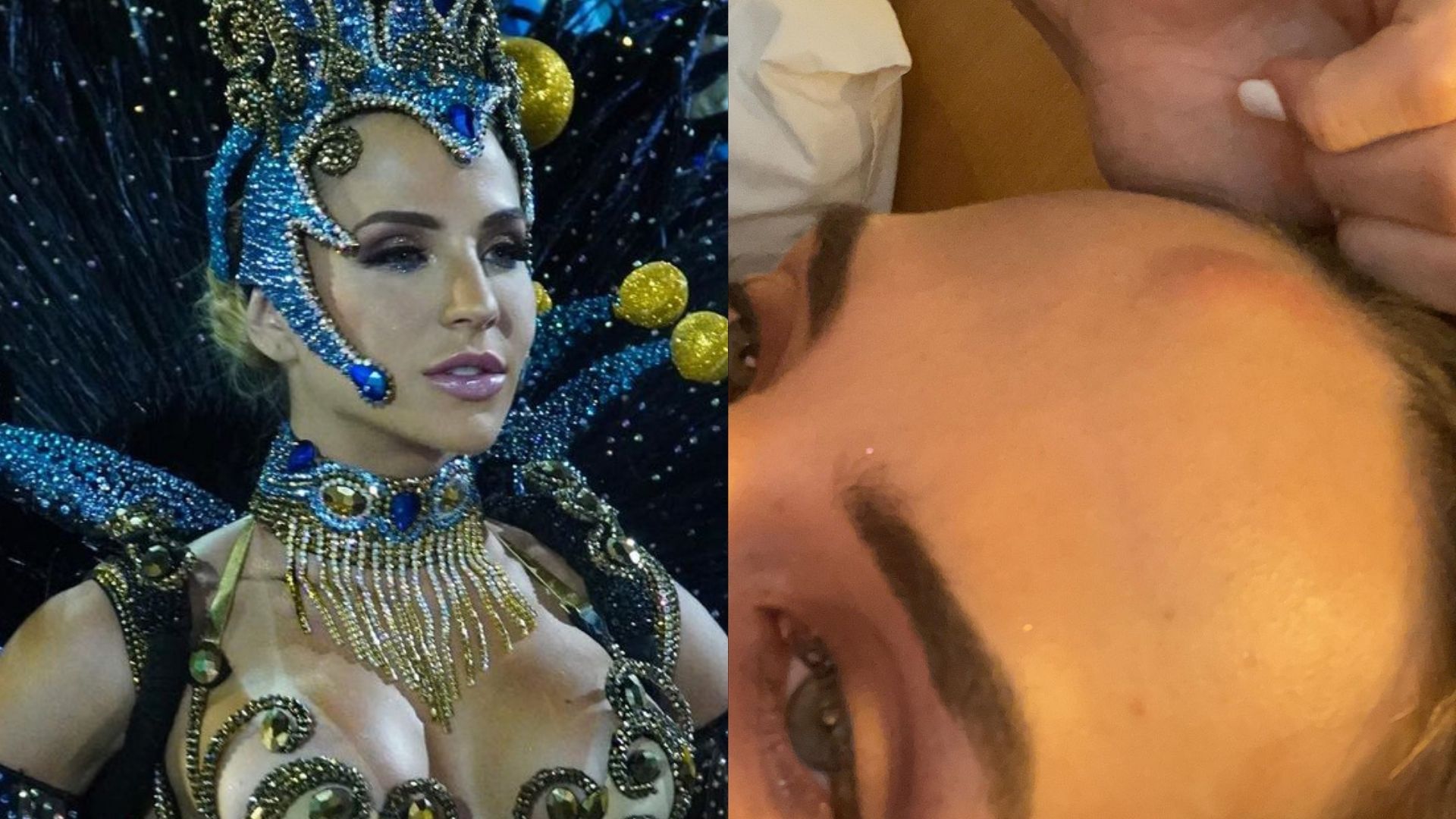 Gabi Martins surge machucada após desfile na Sapucaí: “Toda ralada”