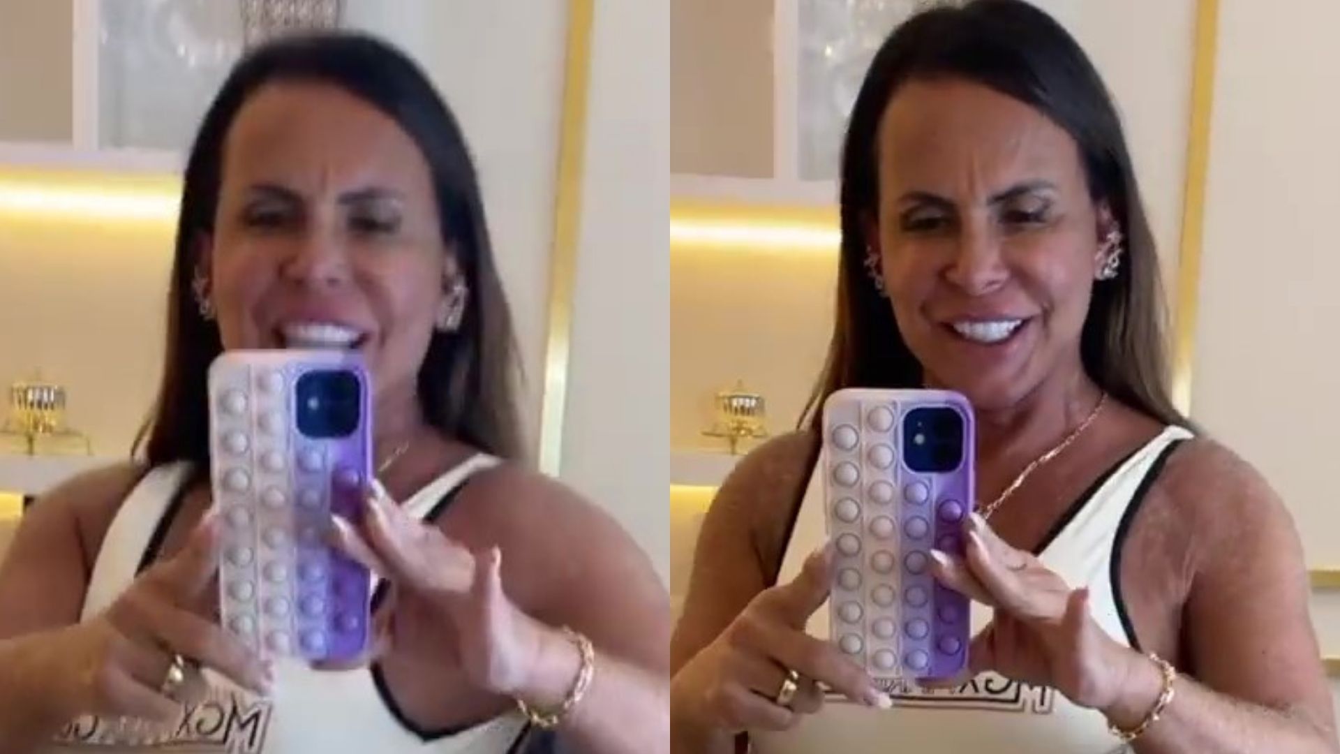Gretchen deixa bumbum na lua após aplicação e mostra detalhes: “Está real”