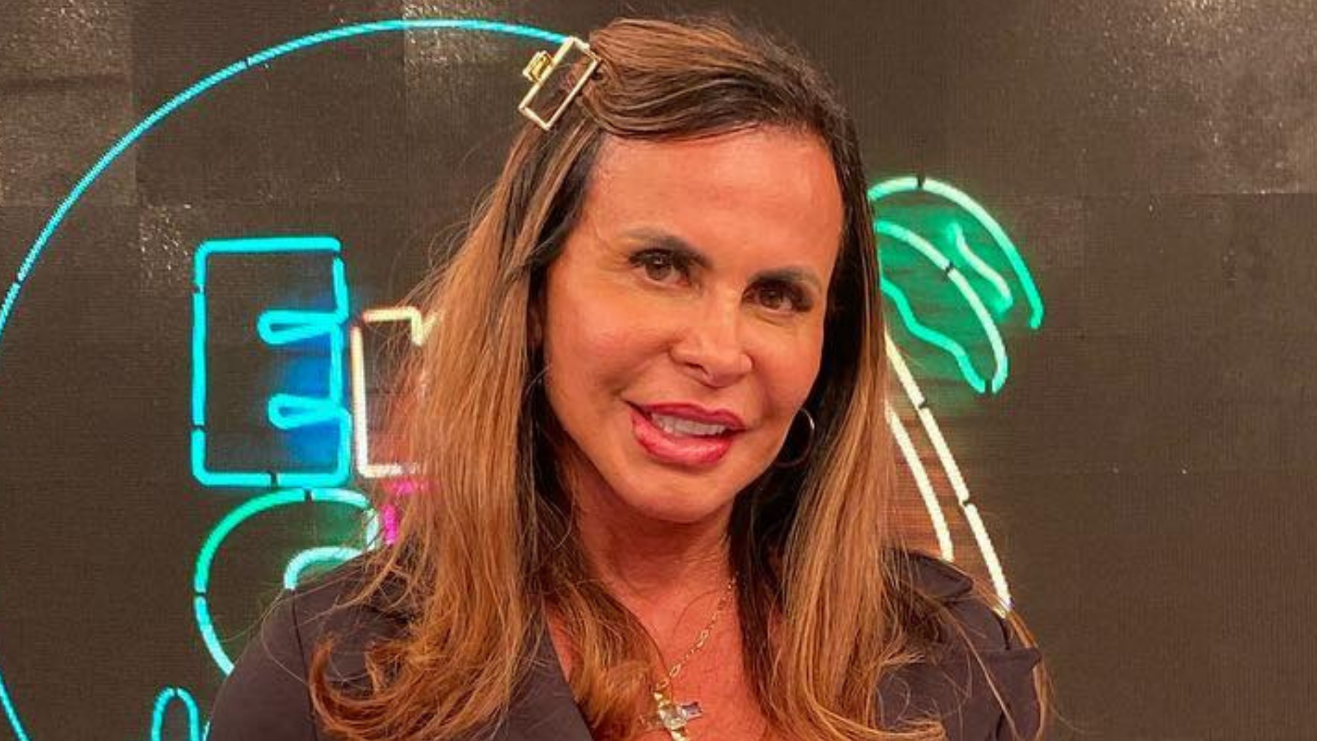 Gretchen surge irreconhecível após procedimentos estéticos no rosto: “Perfeita”