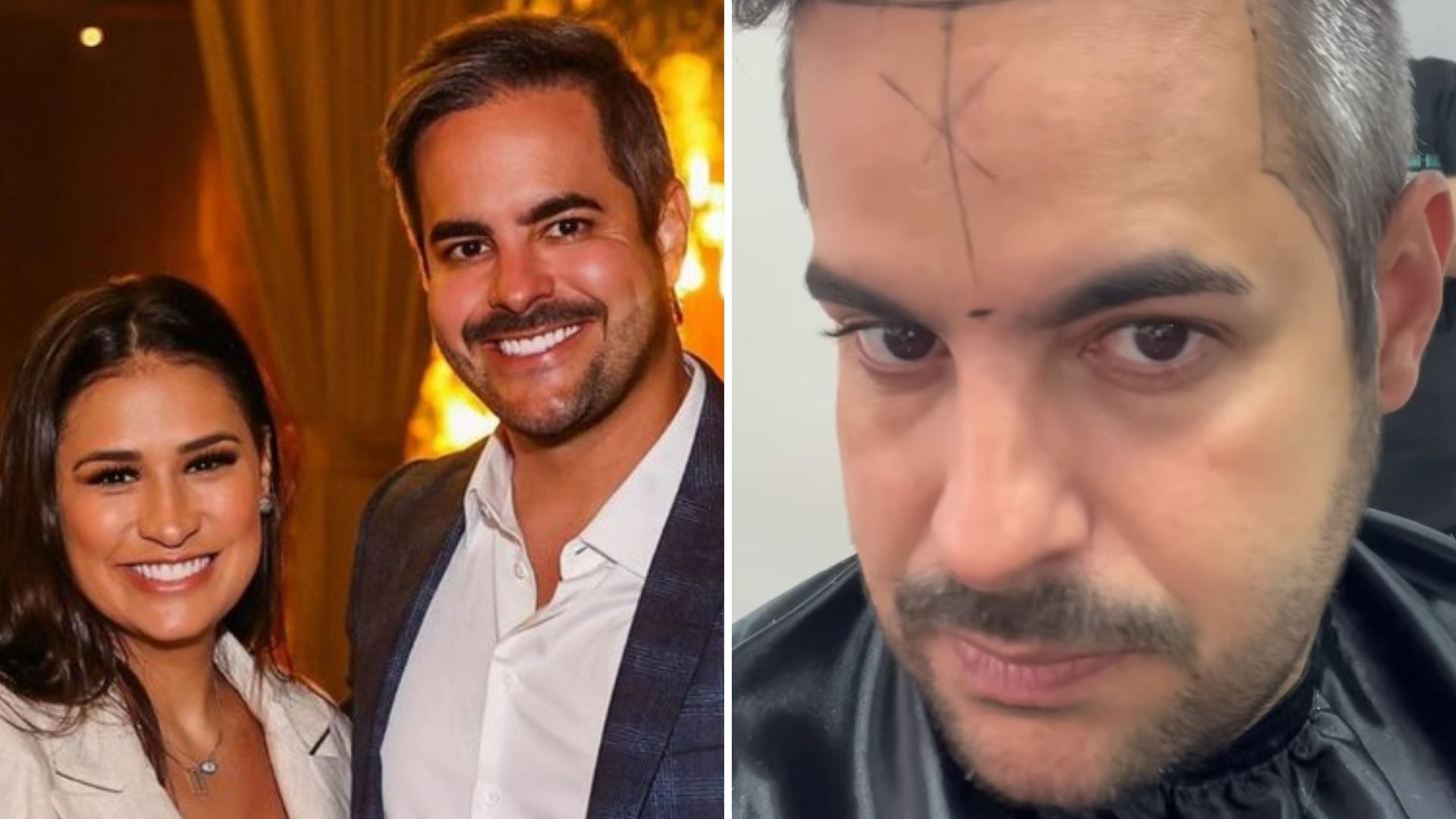 Marido de Simone Mendes, Kaká Diniz realiza transplante capilar: “Muito feliz”