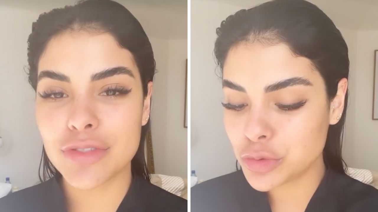 Ex-BBB Munik Nunes passa por ressonância após desconforto e descobre rompimento de prótese: “Vou operar”