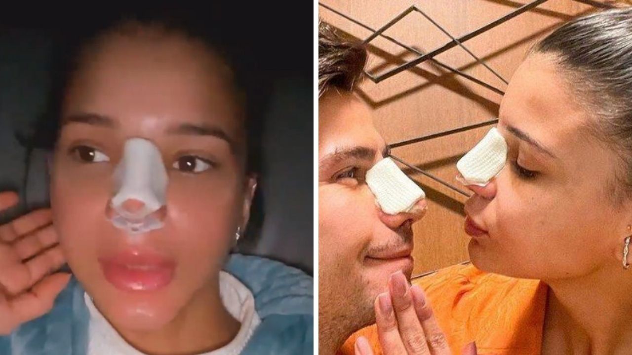 Jakelyne Oliveira conta que ela e Mariano retiraram pedaço da costela para inserir no nariz: “É necessário”