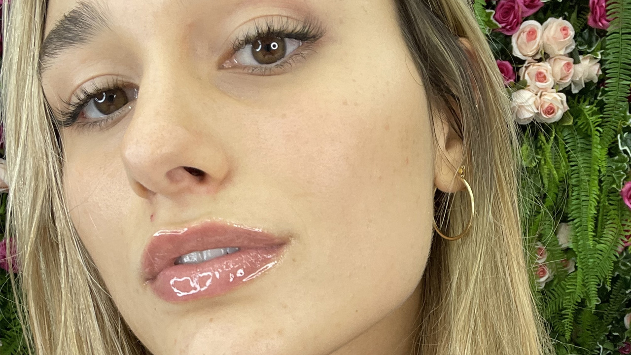 Bem natural, Sasha Meneghel passa por procedimento estético e mostra resultado: “Amei demais”