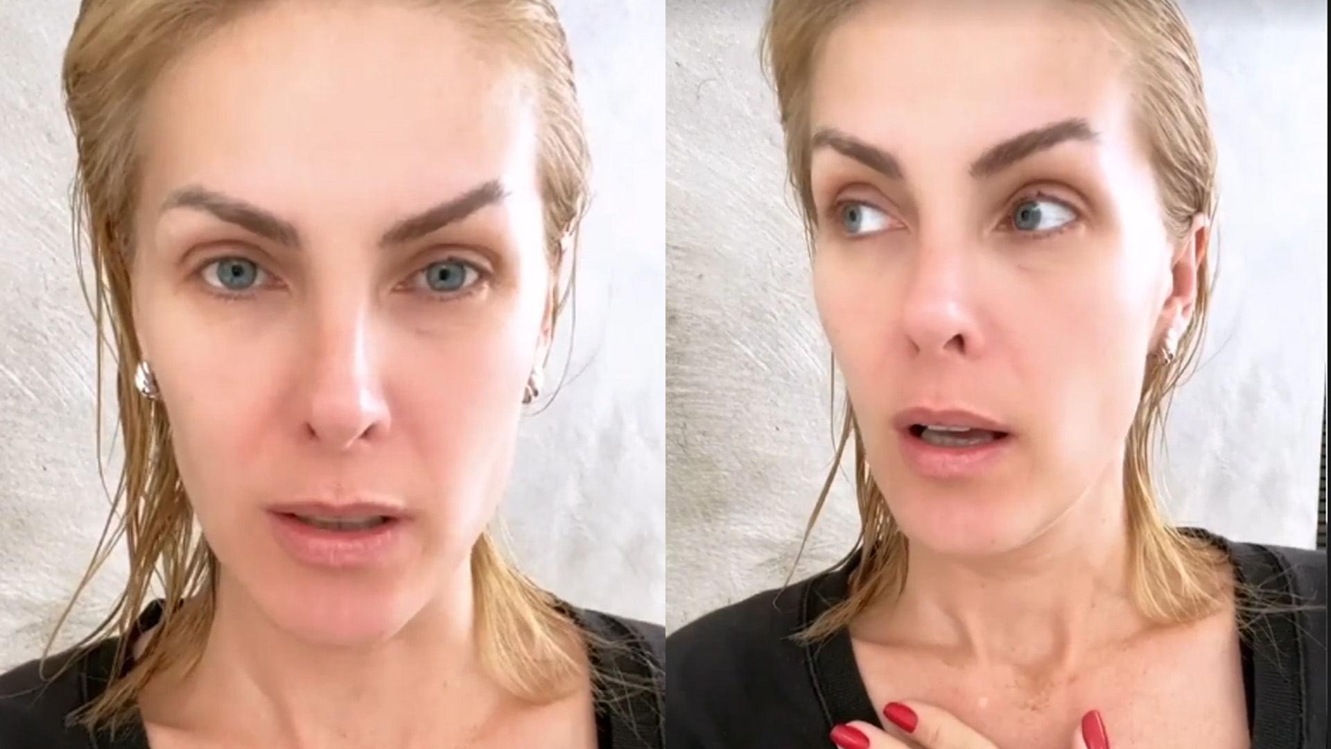 Ana Hickmann sofre acidente doméstico grave e se livra por pouco: “Corte profundo”