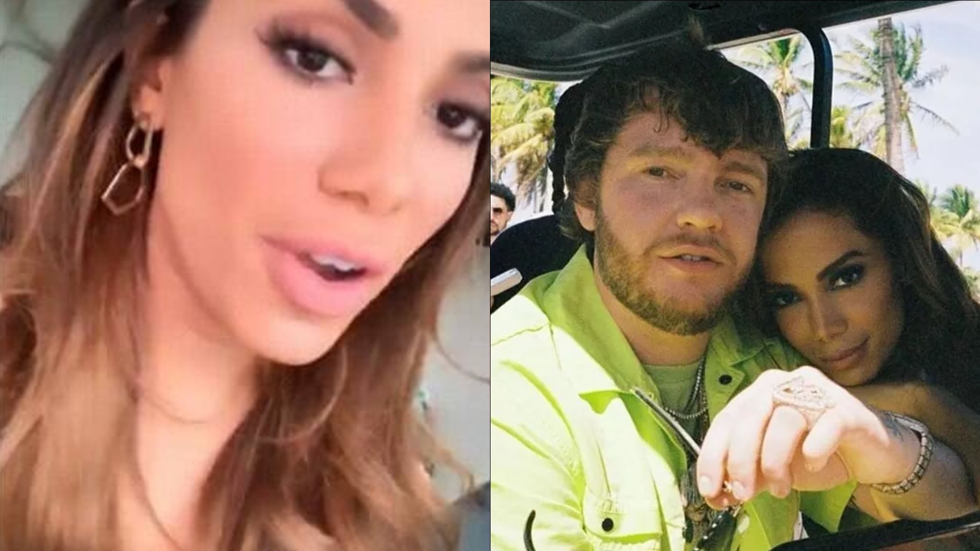 Oi? Anitta confessa medo de expor personalidade na frente do namorado: “Tive vergonha”