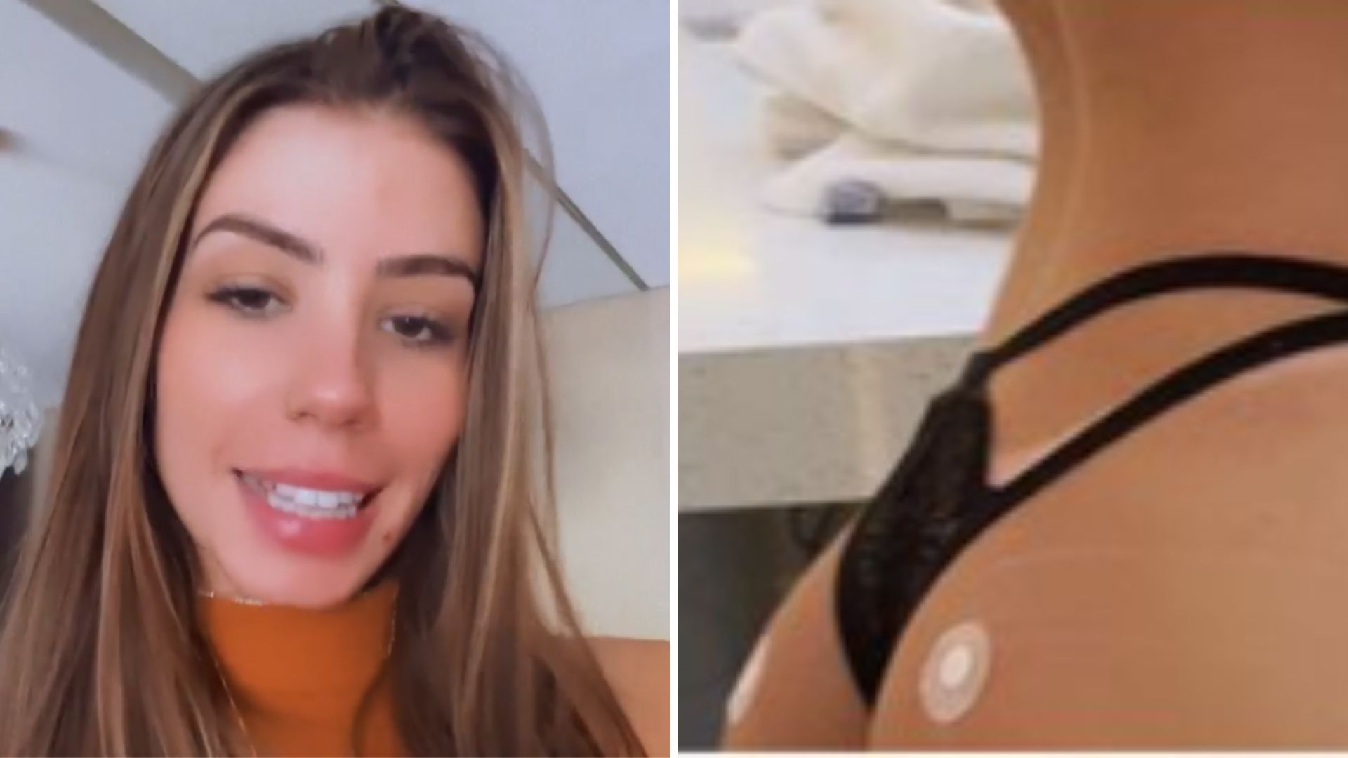 Ex de Whindersson Nunes surge com bumbum “furado” após procedimento radical: “Viciada”