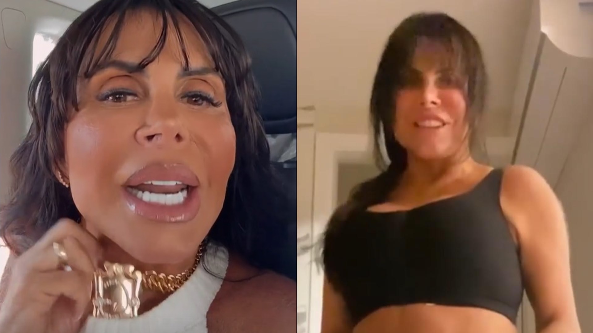 Gretchen é humilhada por seguidora ao expor resultado de lipo e massacra: “Doente de inveja”