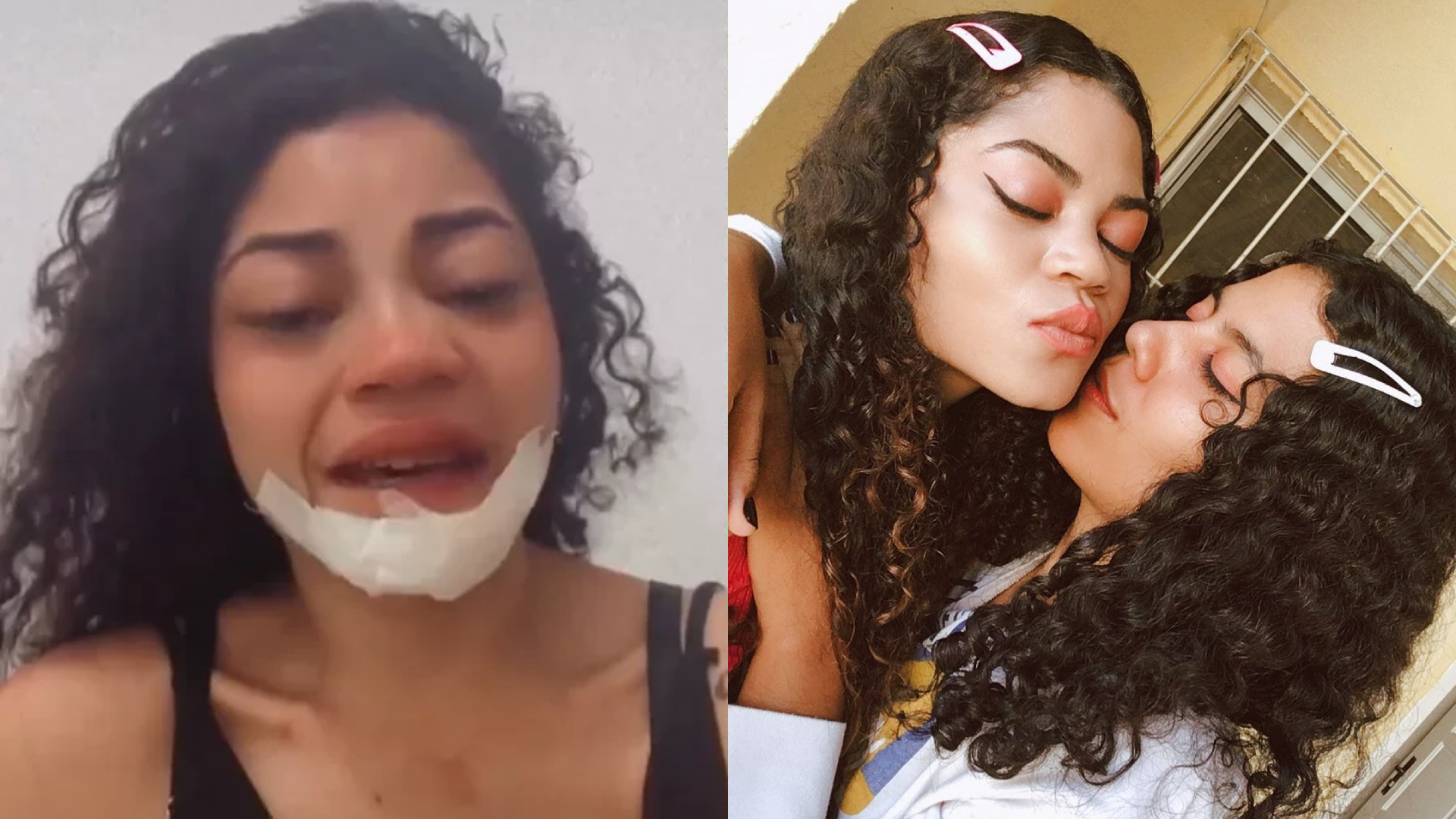 Influenciadora acorda após acidente e descobre morte da namorada: “Muito mal”