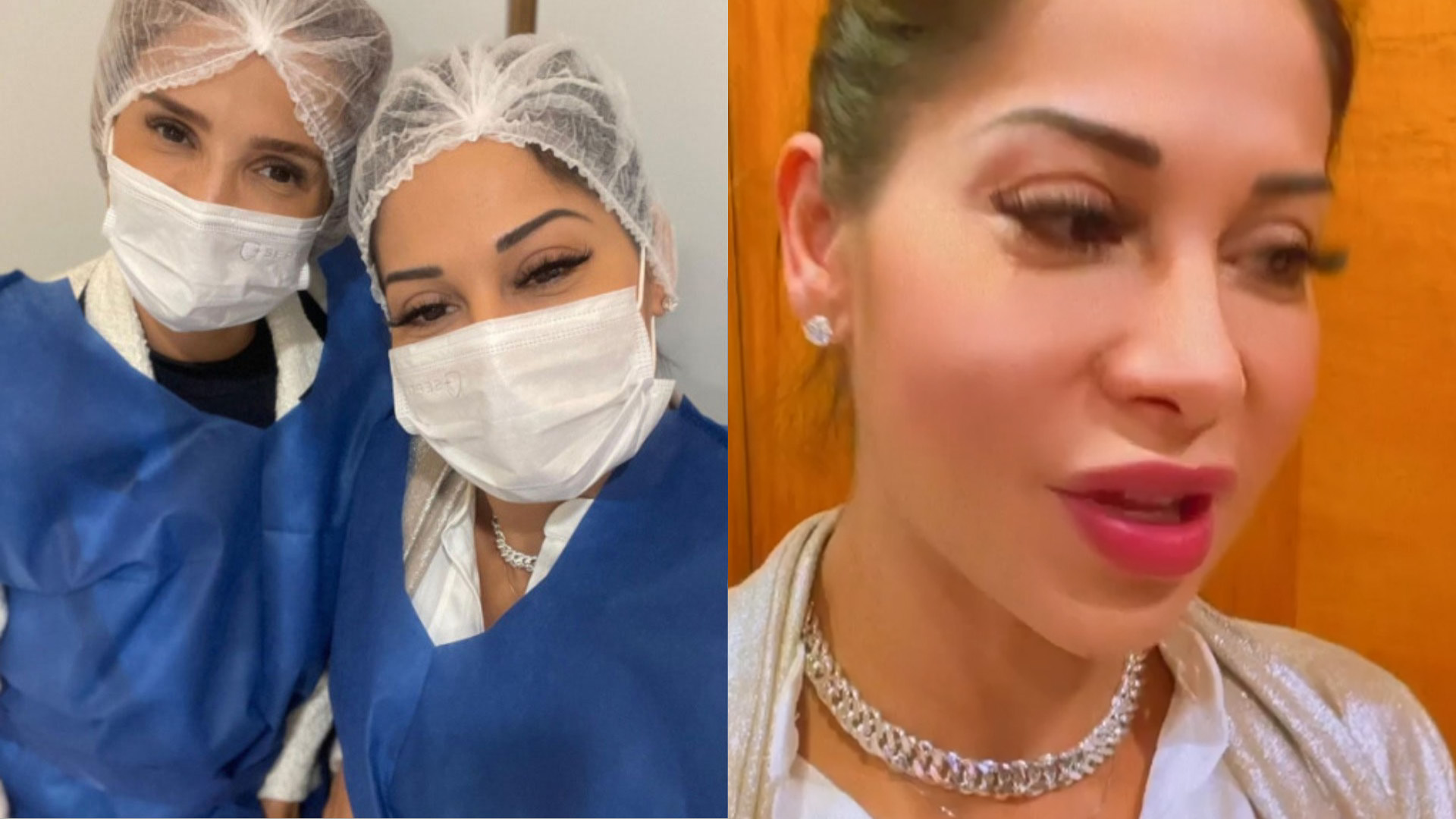 Maíra Cardi passa por cirurgia delicada nos olhos: “Nunca é simples”