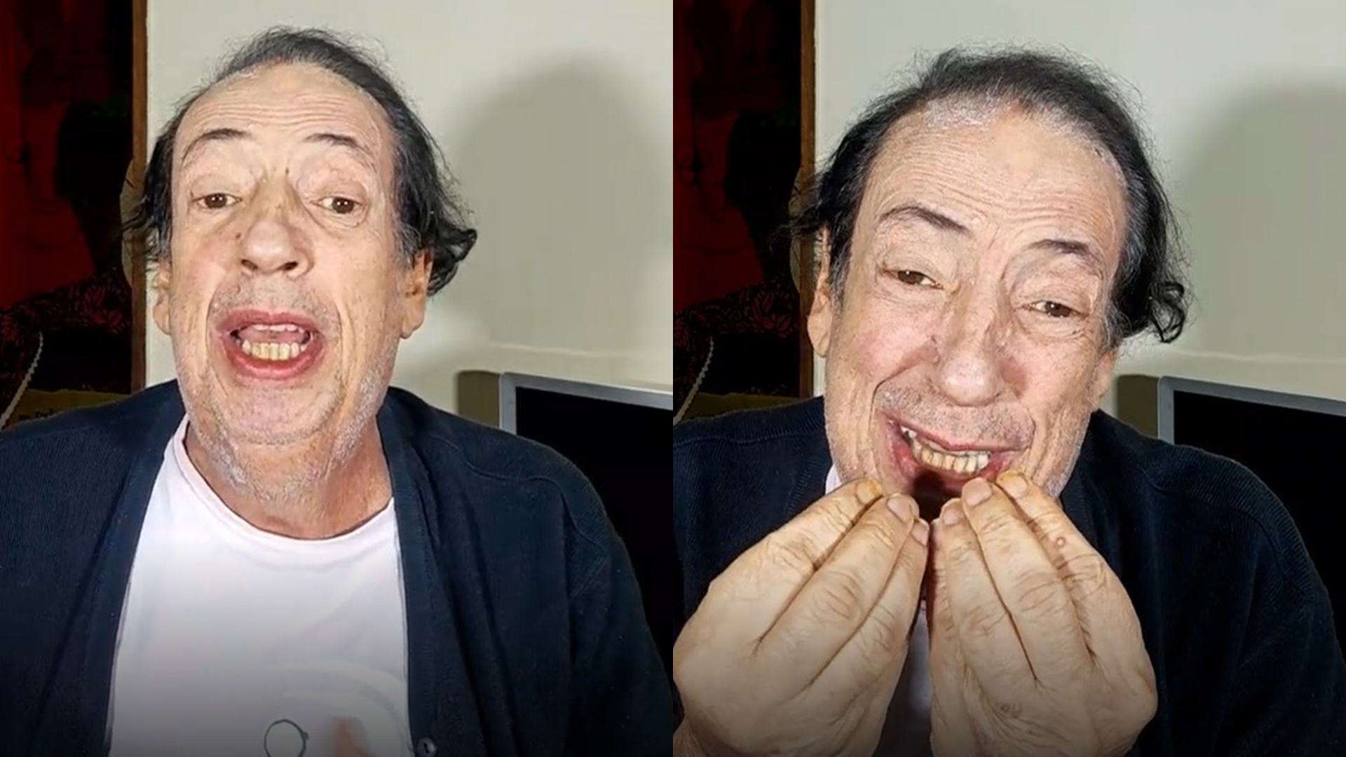 Marcos Oliveira, o eterno Beiçola, volta a implorar por ajuda: “Toda doação importa”