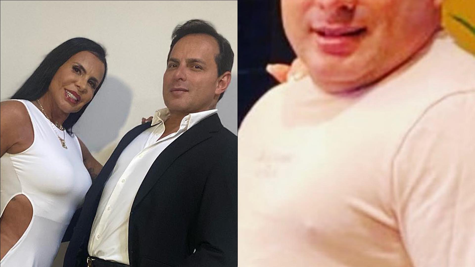 Marido de Gretchen surge irreconhecível antes de plásticas: “Escolhi ser bonito”