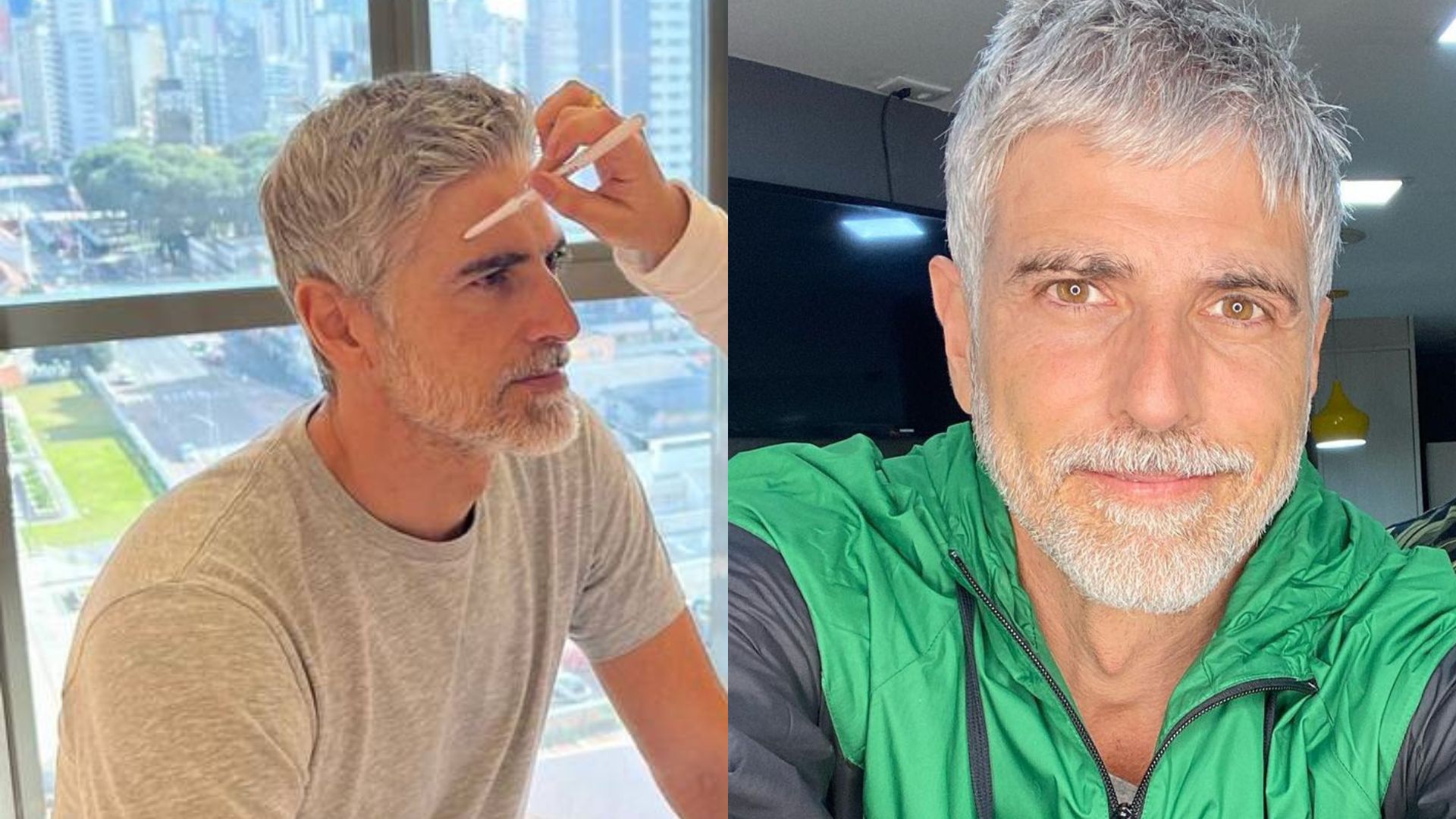 Quase cinquentão, Reynaldo Gianecchini realiza procedimento para parecer mais jovem