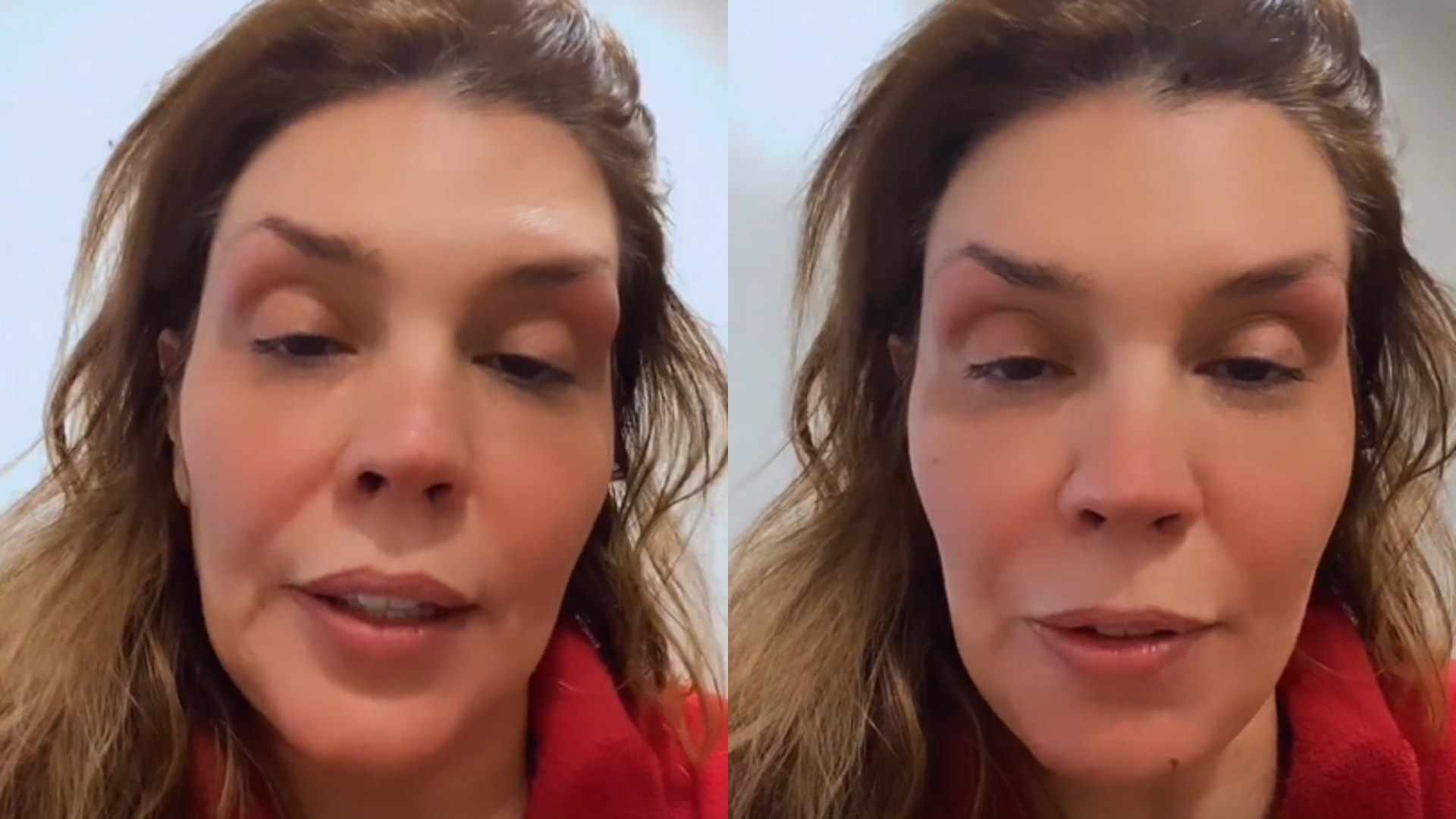 Em luta contra o câncer, Simony desabafa após sessão de quimioterapia: “Orações”