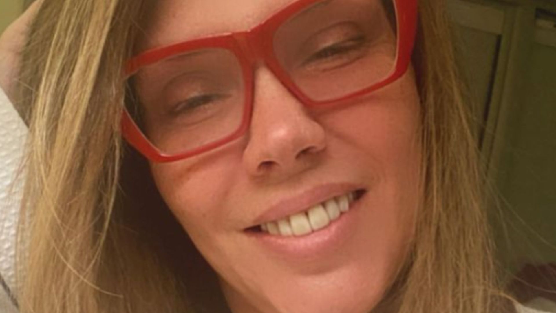 Simony muda o visual durante sessões de quimioterapia: “Desapegando da vaidade”