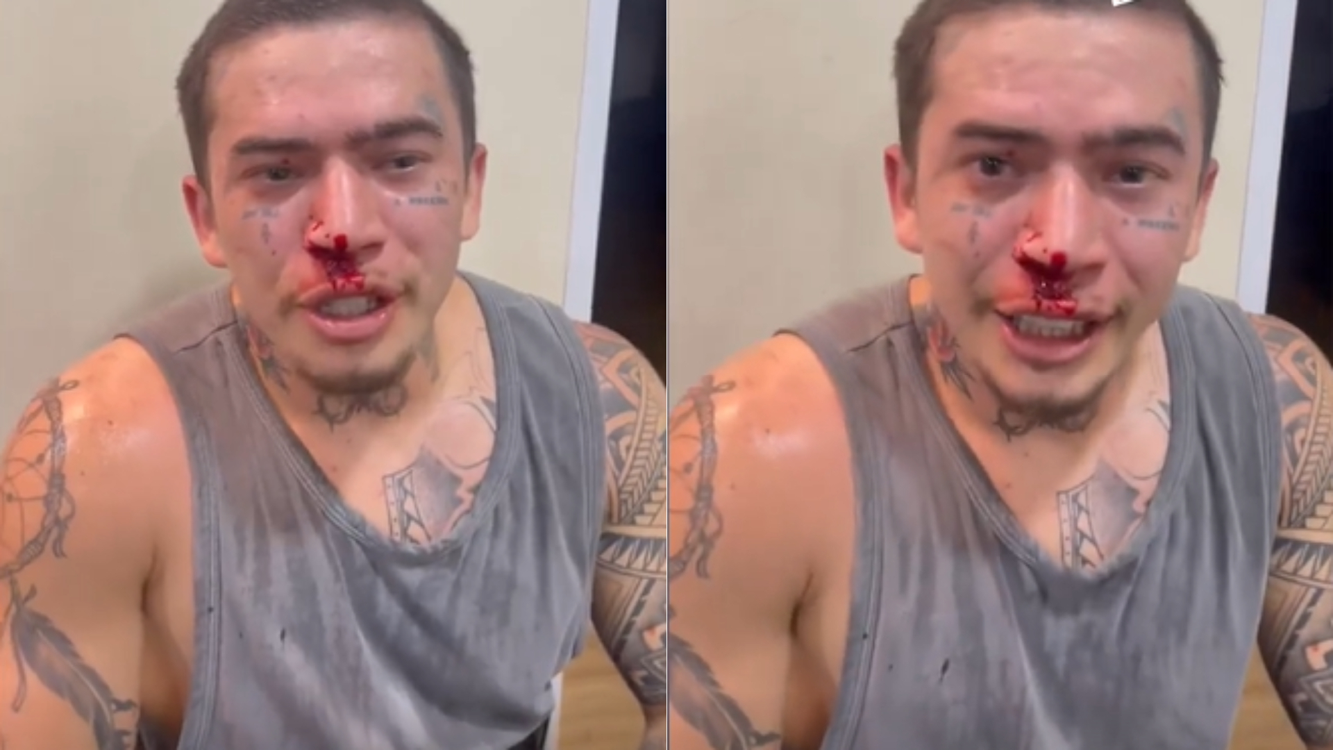 Whindersson Nunes surge com o rosto coberto de sangue: “Mexi com o cara errado”