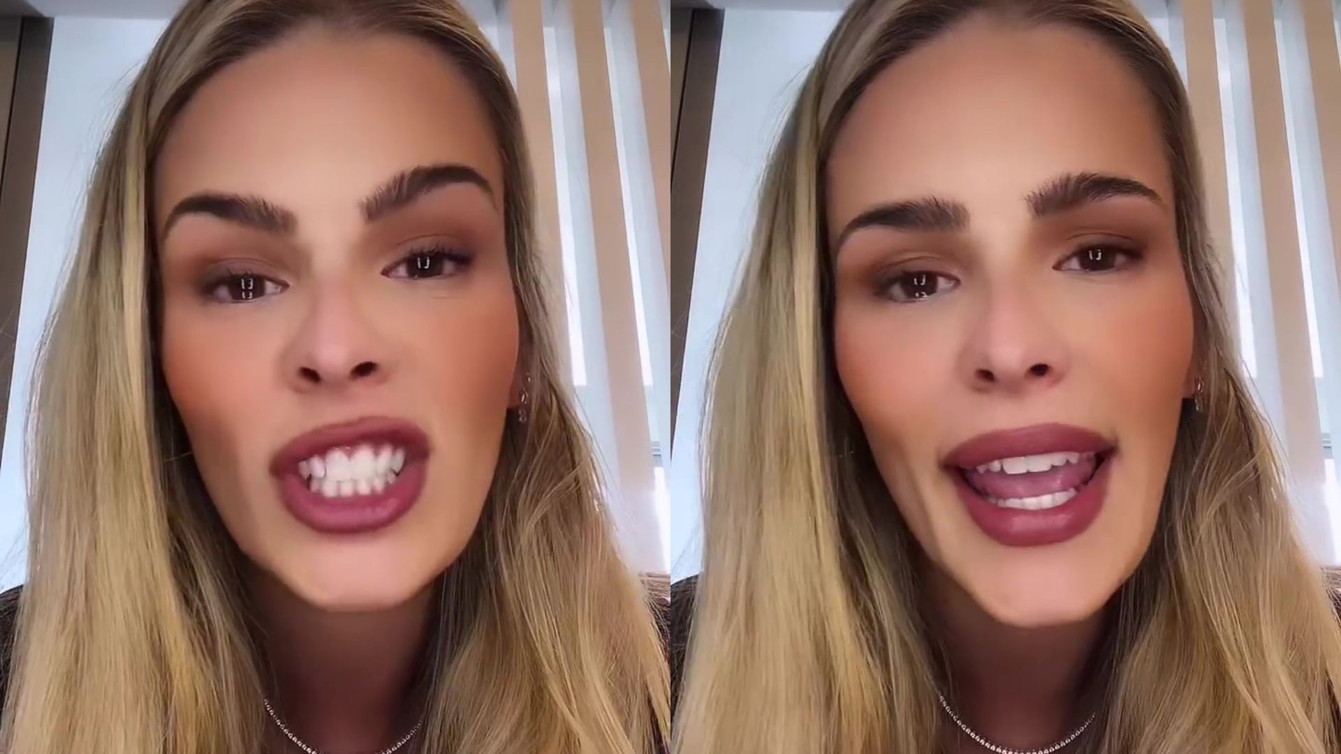 Surtou! Yasmin Brunet chega no limite e afronta haters: “Eu vou ser a vilã”