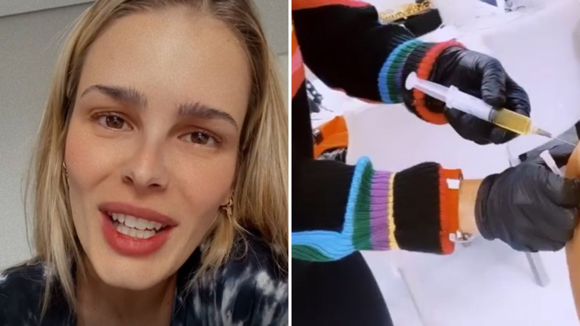 Yasmin Brunet passa por procedimento invasivo e mostra bumbum sendo furado: “Com medo”