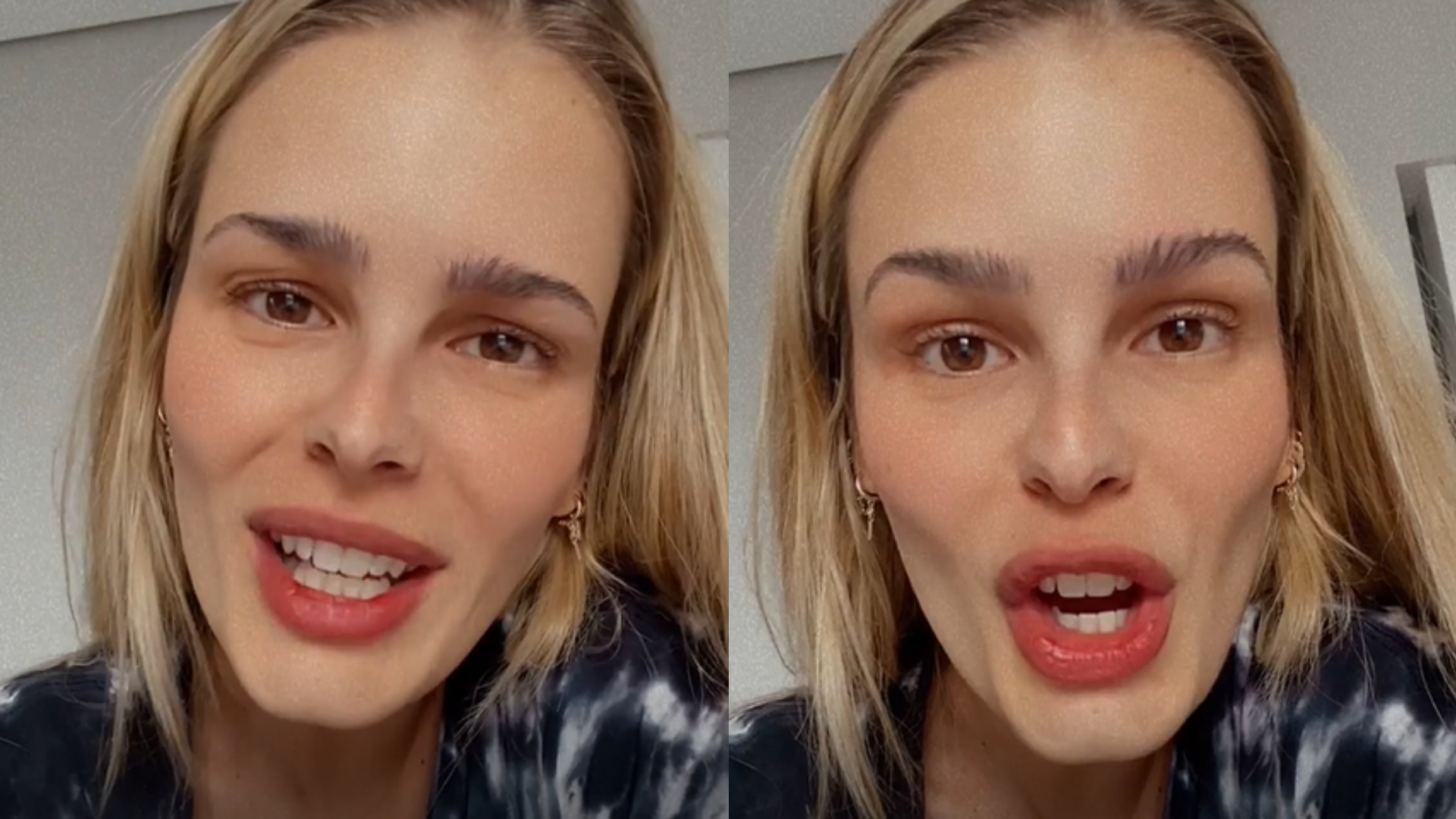 Yasmin Brunet se justifica após dizer que meditação curou câncer: “Distorcido”