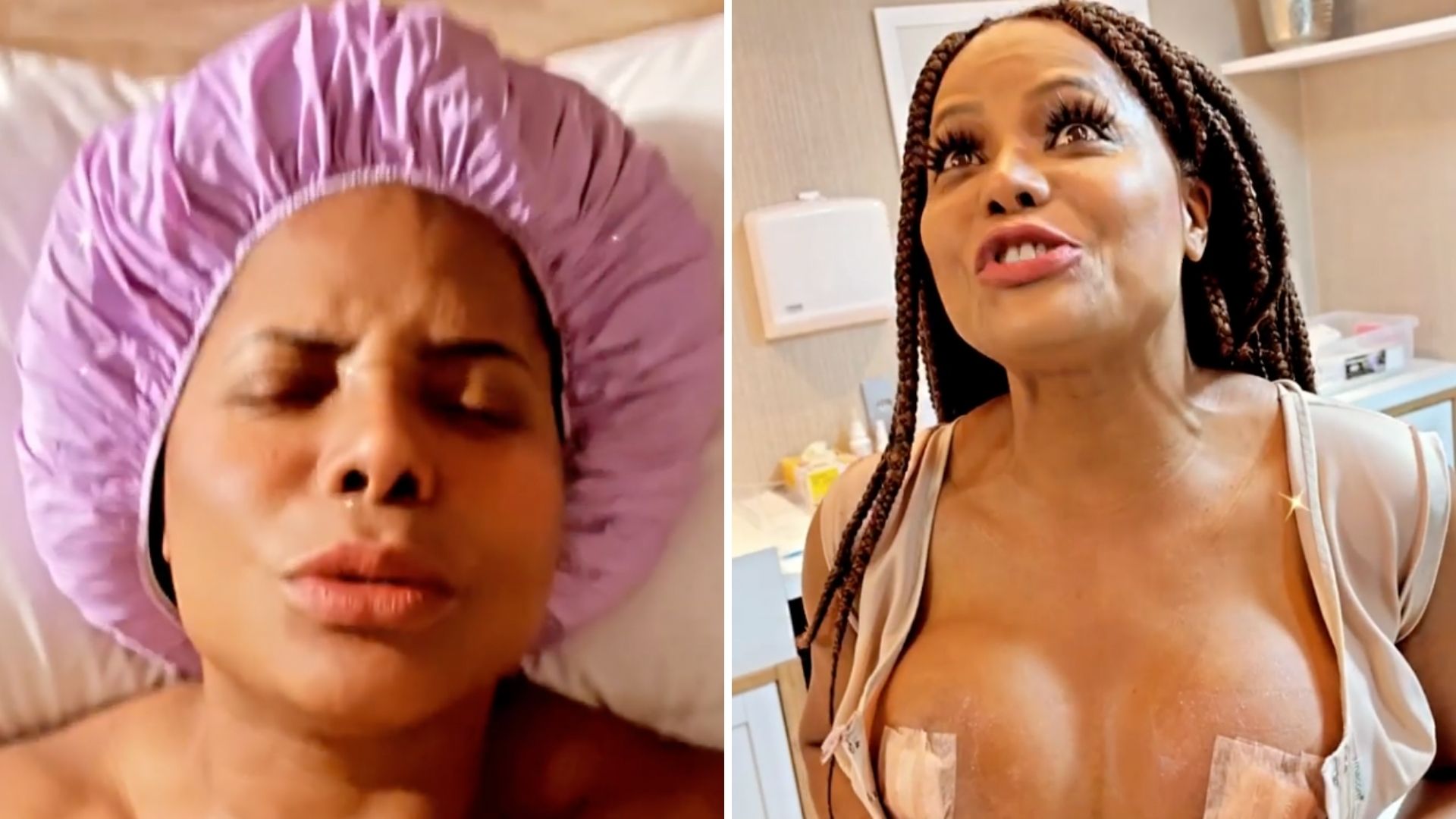 Adriana Bombom passa por cirurgia de reconstrução dos seios: “Recomeço”