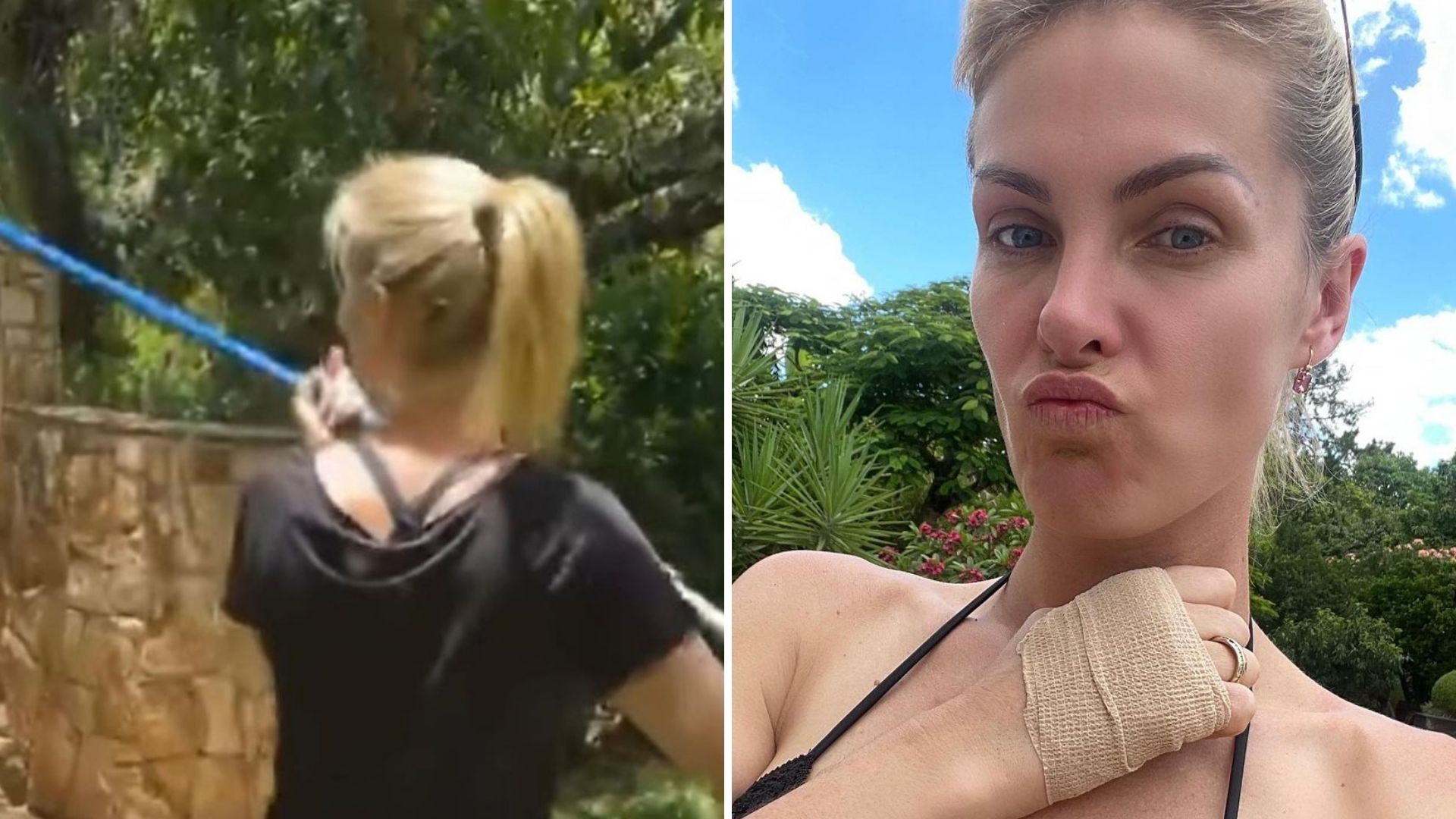 Que susto! Ana Hickmann sofre acidente doméstico e se machuca: “Belo corte”