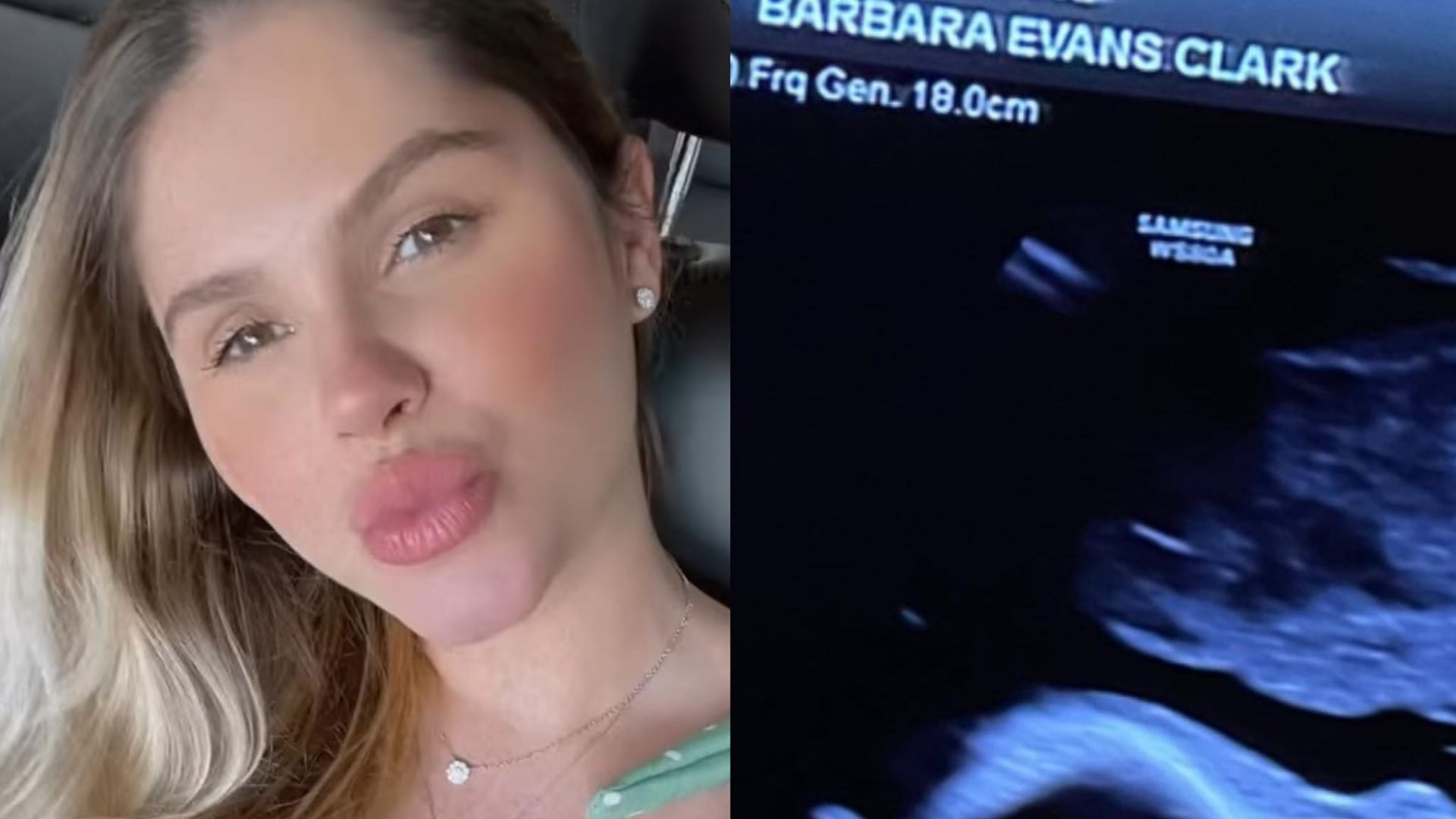 Grávida, Bárbara Evans baba ao expor silhueta encantadora da filha: “Está perfeita”