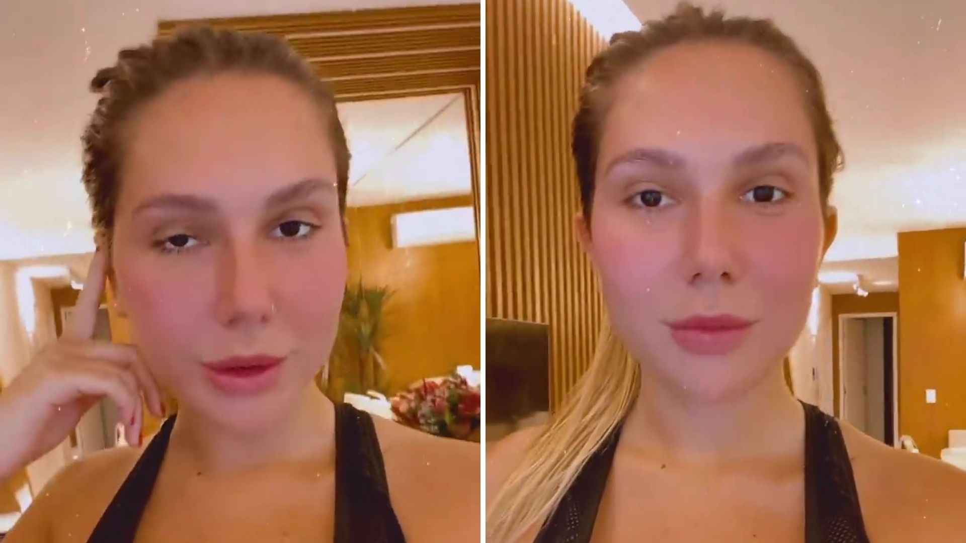 Filha do Renato Gaúcho confessa insegurança com orelhas de abano: “Trauma real”