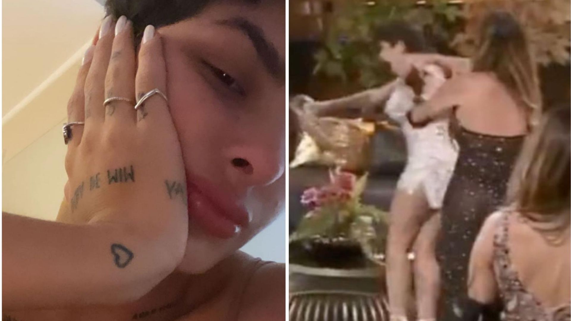 A Fazenda 13: Lary Bottino expõe ferimentos após agressão: “Dói”