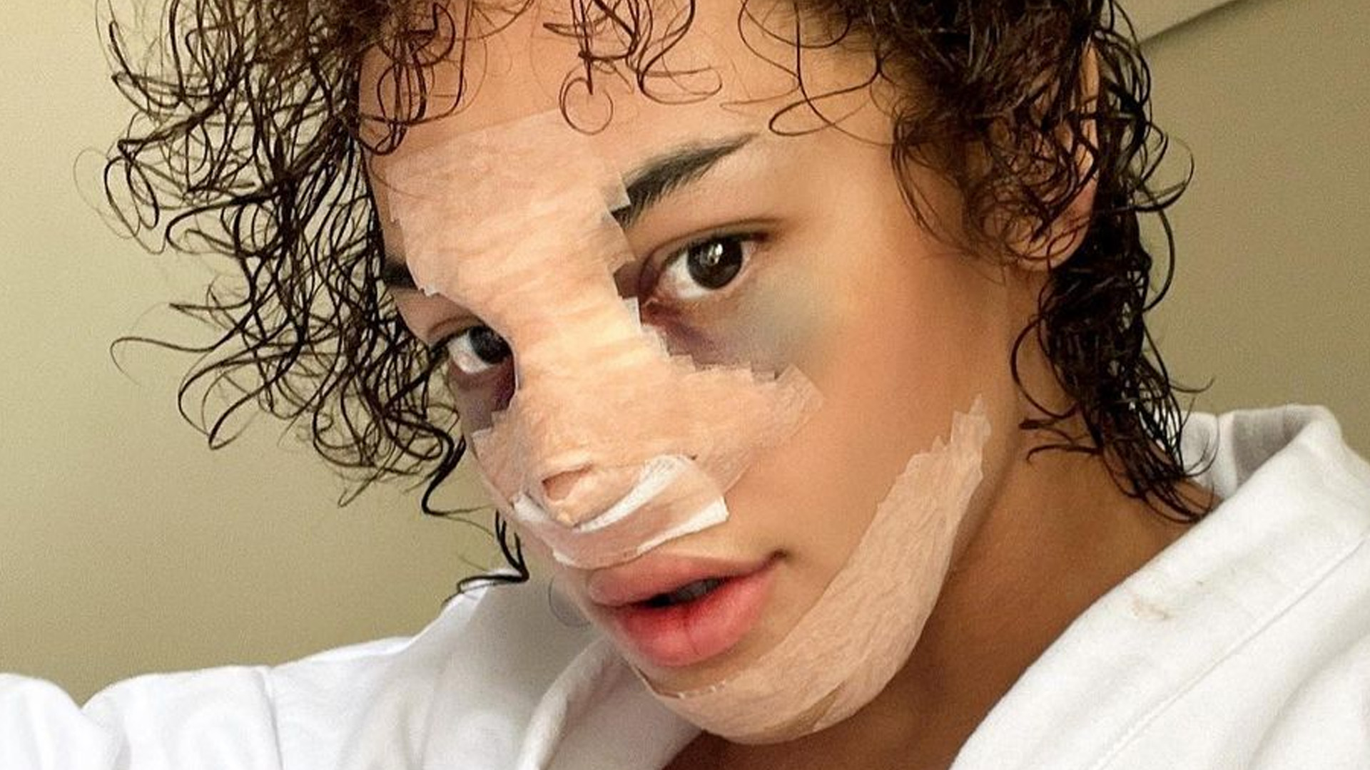 Pabllo Vittar revela plástica em área escondida: “Tá cheio de ponto”