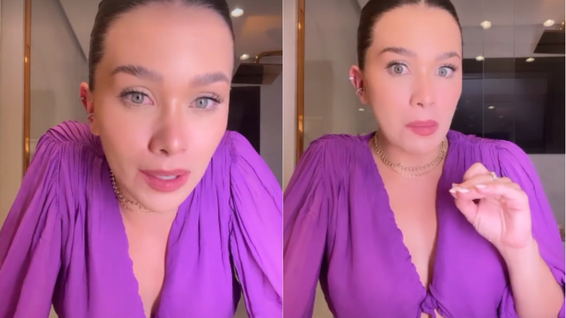 Flavia Pavanelli revela verdadeiro motivo para remoção de preenchimento labial