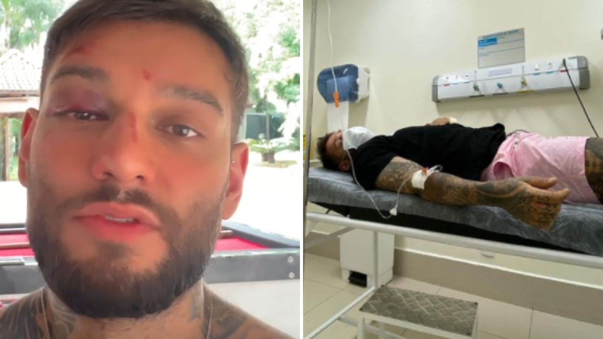 Lucas Lucco sofre acidente e tem parte do corpo quebrado: “Caí em cima”
