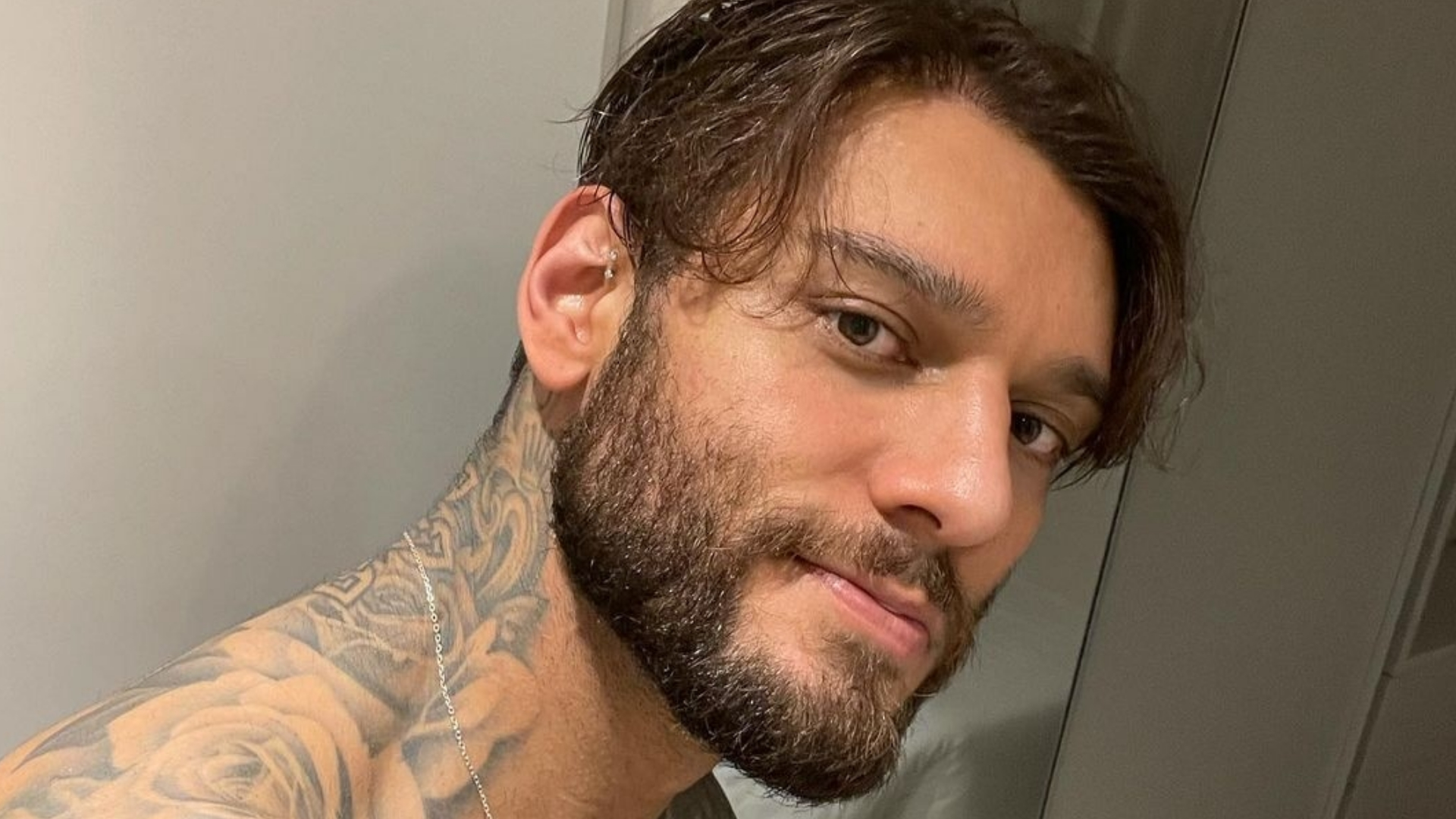 Lucas Lucco mostra machucados após acidente em casa: “Tô melhor”