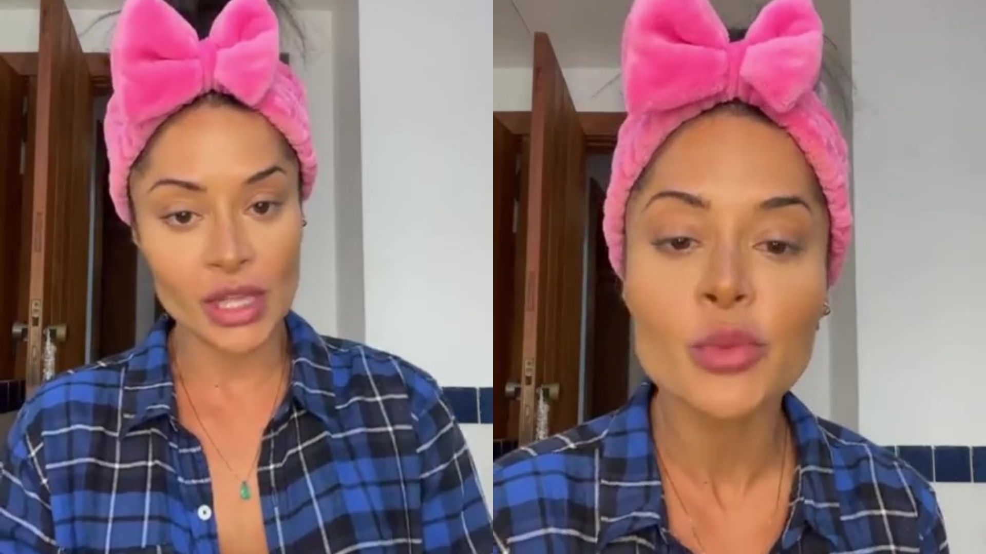 Aline Campos exagera nos procedimentos estéticos e se arrepende: “Aprendizados”