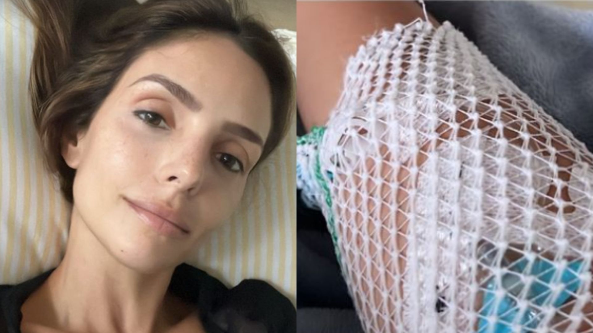 Carol Celico é internada com diagnóstico preocupante no intestino: “Muito forte”