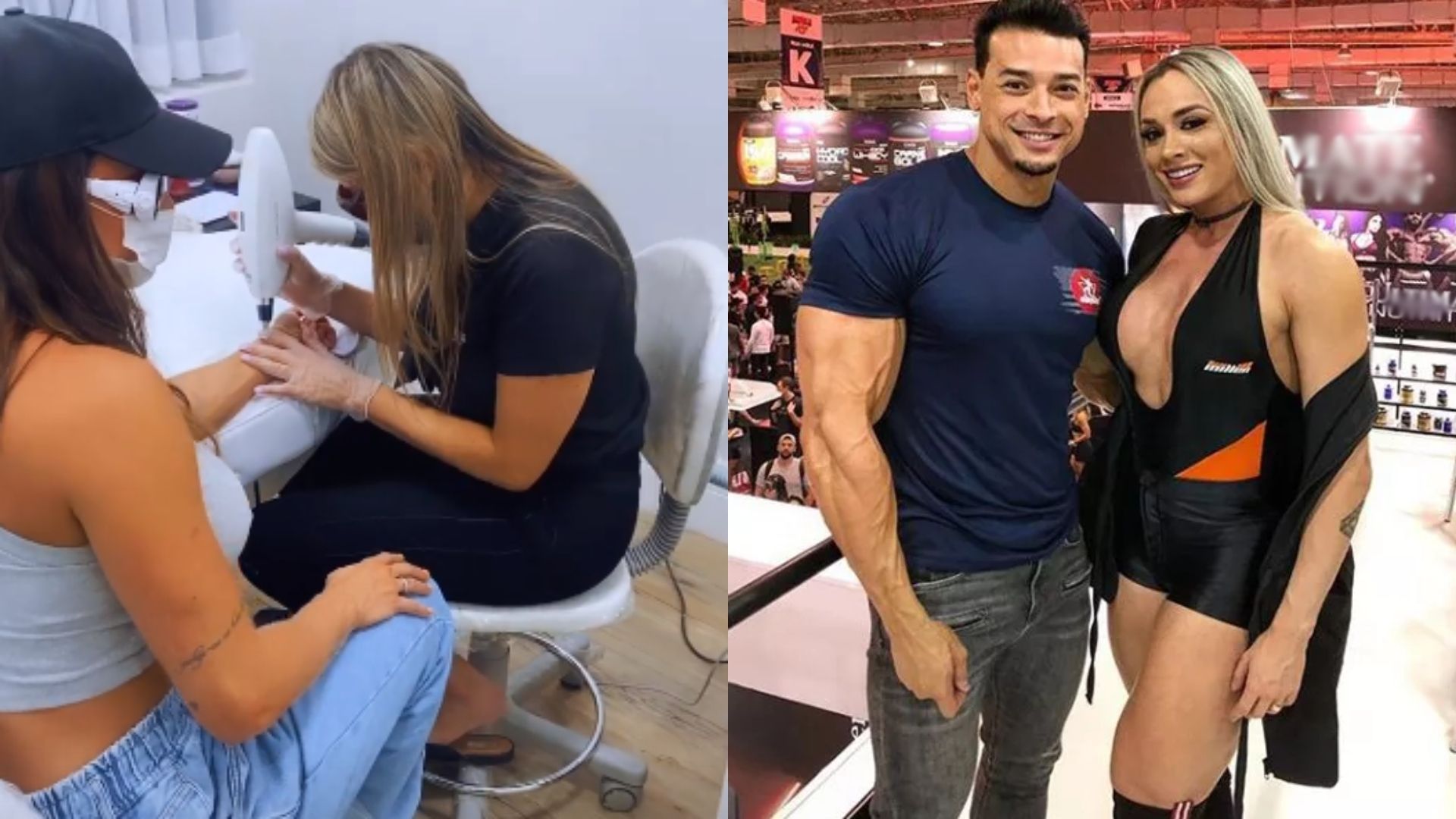 Juju Salimeni remove tatuagem em homenagem ao ex-marido, Felipe Franco: “Zerada”