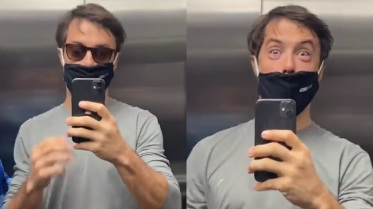 Kayky Brito é enganado por farmacêutico e tem reação alérgica a anti-inflamatório: “Falou que não ia inchar”