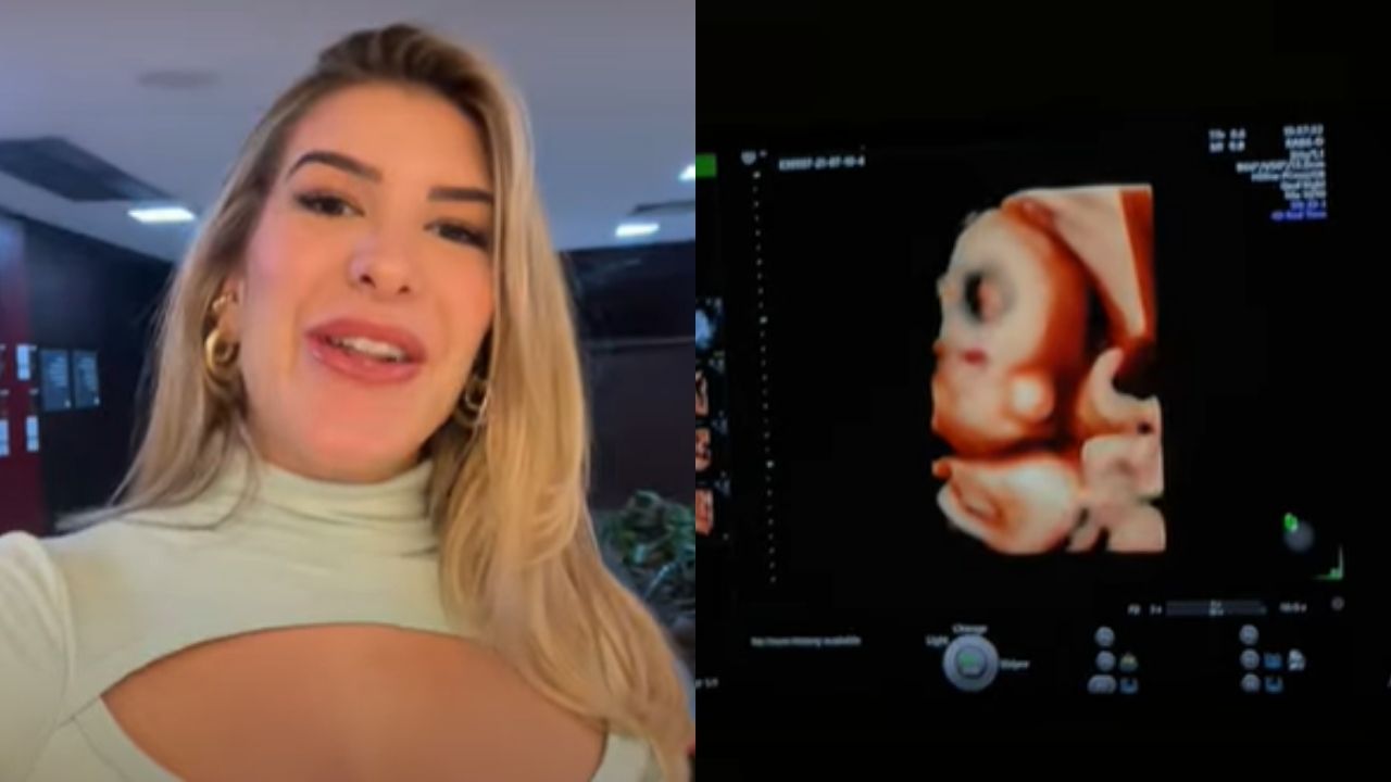 Gravidíssima, Lore Improta descobre rostinho da filha em ultrassom 4D e se choca com semelhança: “Cara de Léo”